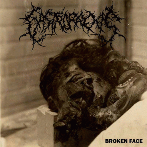 Gastrorrexis : Broken Face Gastrorrexis : Broken Face